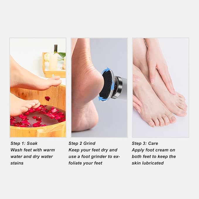 Cordless Callus Remover Machine v1