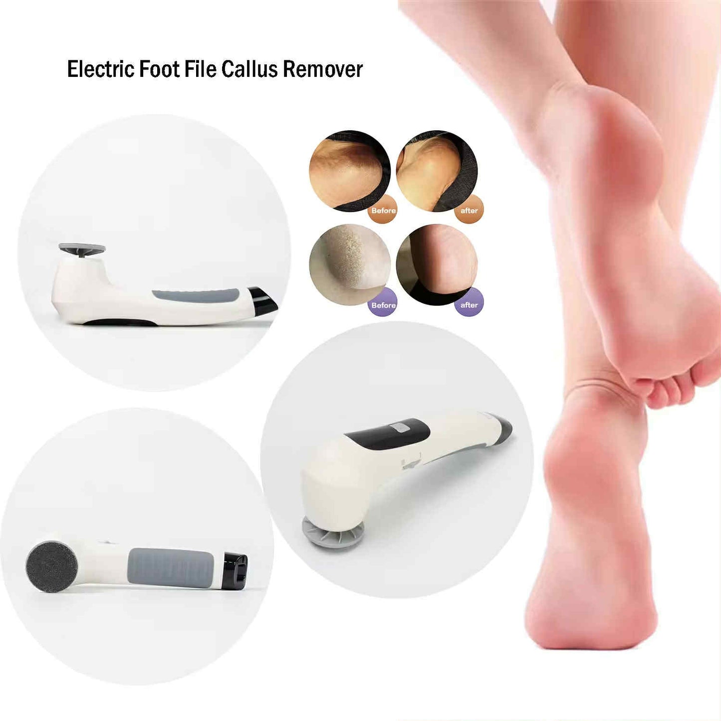 Cordless Callus Remover Machine
